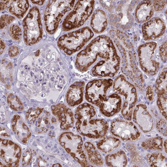 GLDC Antibody in Immunohistochemistry (IHC)