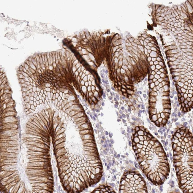 Nhe-1 Antibody in Immunohistochemistry (IHC)