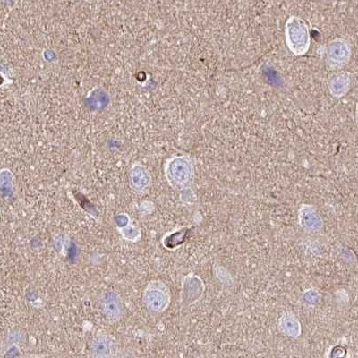 Nhe-1 Antibody in Immunohistochemistry (IHC)