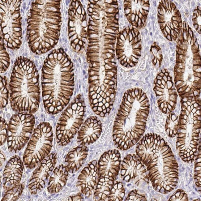 Nhe-1 Antibody in Immunohistochemistry (IHC)