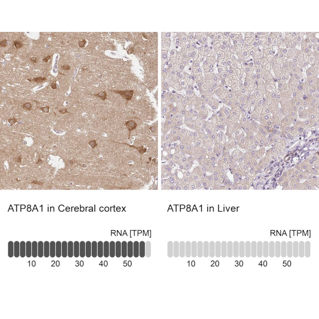 ATP8A1 Antibody in Immunohistochemistry (IHC)