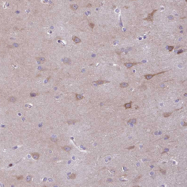 AdoHcyase 3 Antibody in Immunohistochemistry (IHC)