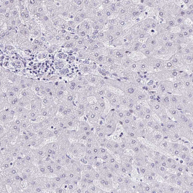 AdoHcyase 3 Antibody in Immunohistochemistry (IHC)