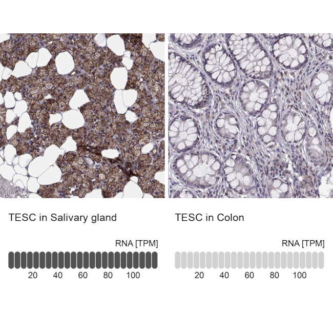 TESC Antibody in Immunohistochemistry (IHC)