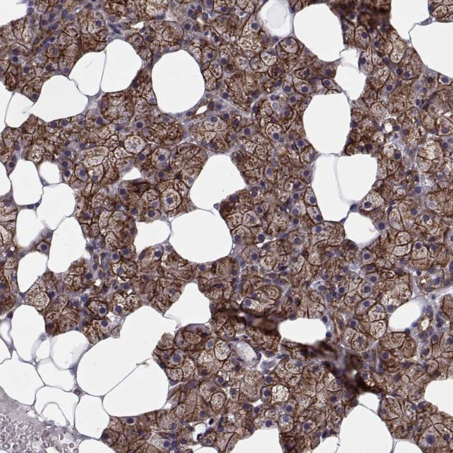 TESC Antibody in Immunohistochemistry (IHC)