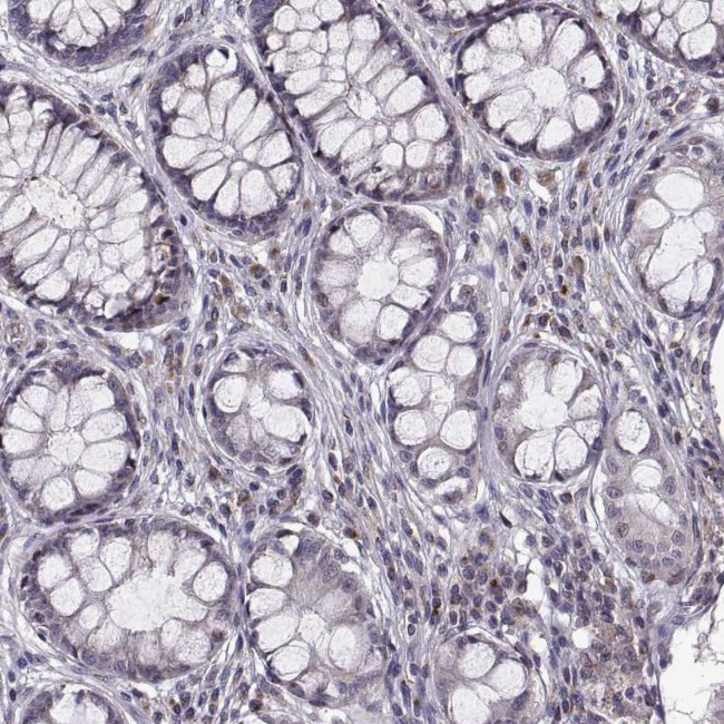 TESC Antibody in Immunohistochemistry (IHC)