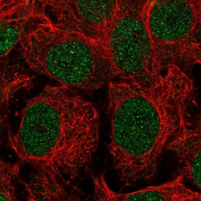 VPRBP Antibody in Immunocytochemistry (ICC/IF)