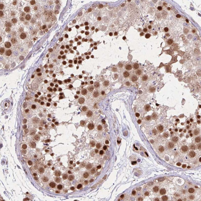 RAD21L1 Antibody in Immunohistochemistry (IHC)