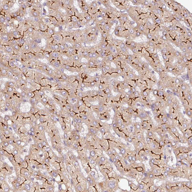 ABCB4 Antibody in Immunohistochemistry (IHC)