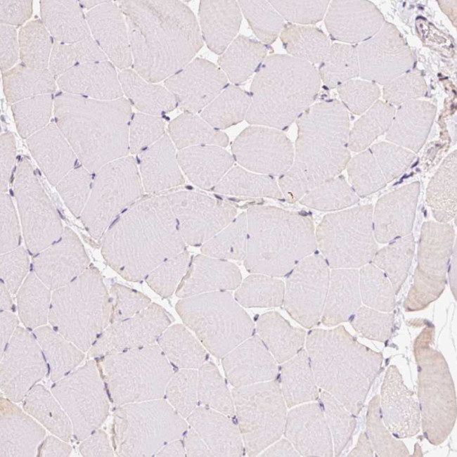 ABCB4 Antibody in Immunohistochemistry (IHC)