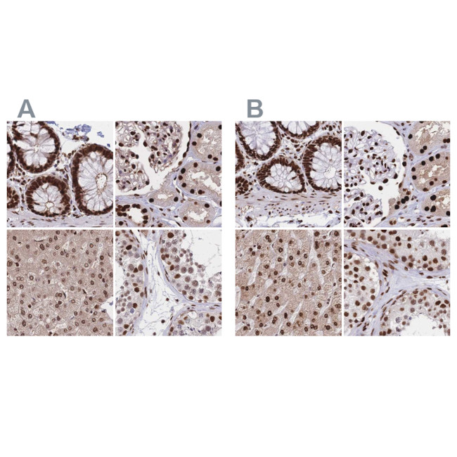 HDGF Antibody in Immunohistochemistry (IHC)