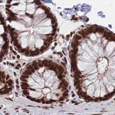 HDGF Antibody in Immunohistochemistry (IHC)