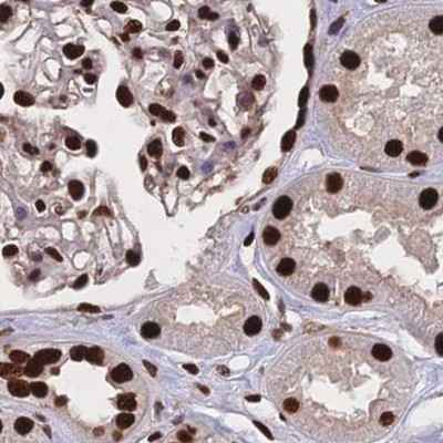 HDGF Antibody in Immunohistochemistry (IHC)