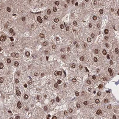 HDGF Antibody in Immunohistochemistry (IHC)