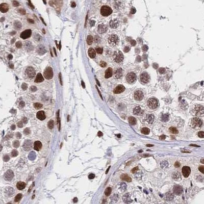 HDGF Antibody in Immunohistochemistry (IHC)