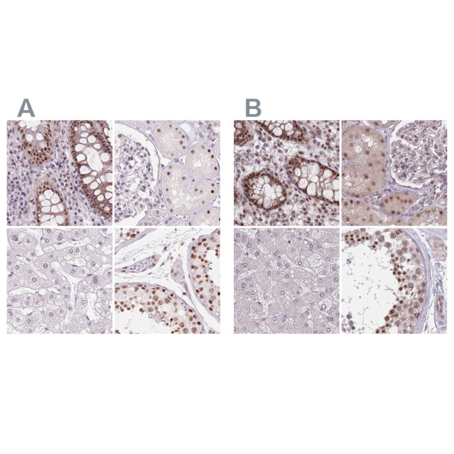 ZC3H14 Antibody in Immunohistochemistry (IHC)