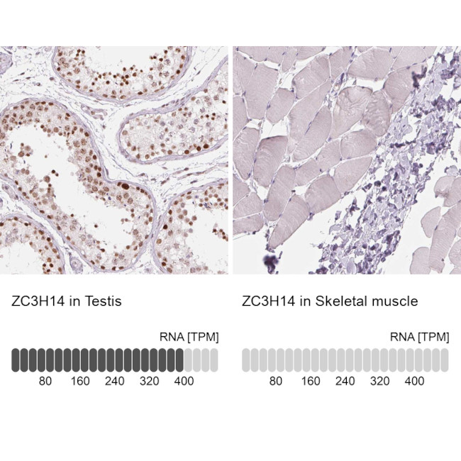 ZC3H14 Antibody