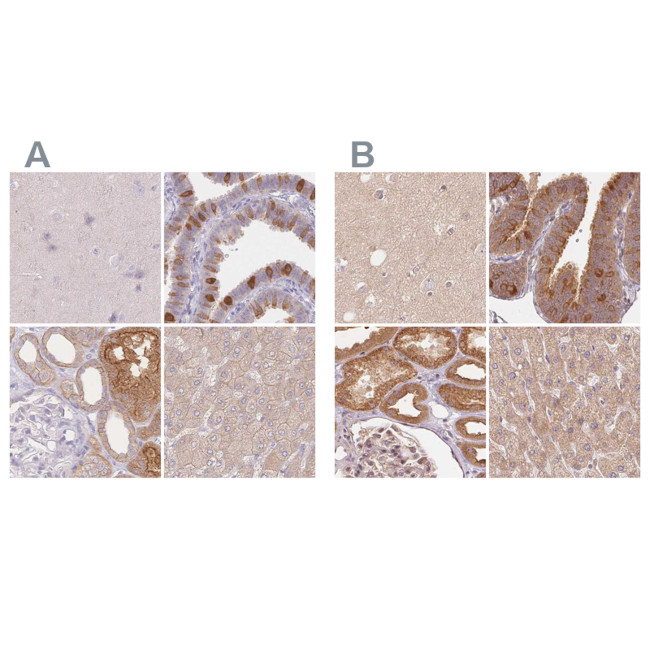 WDR54 Antibody in Immunohistochemistry (IHC)