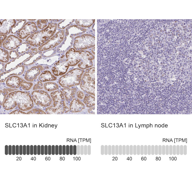 SLC13A1 Antibody in Immunohistochemistry (IHC)