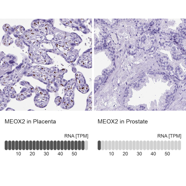 MEOX2 Antibody in Immunohistochemistry (IHC)