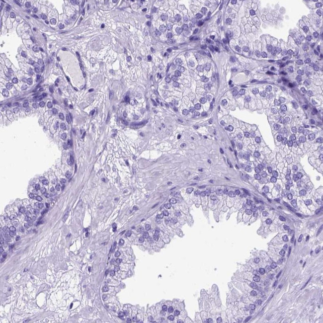 MEOX2 Antibody in Immunohistochemistry (IHC)