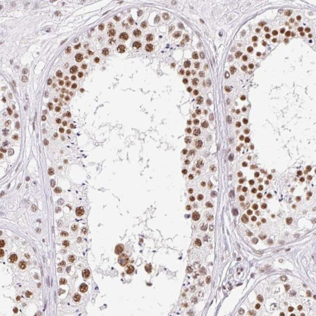 FUSIP1 Antibody in Immunohistochemistry (IHC)