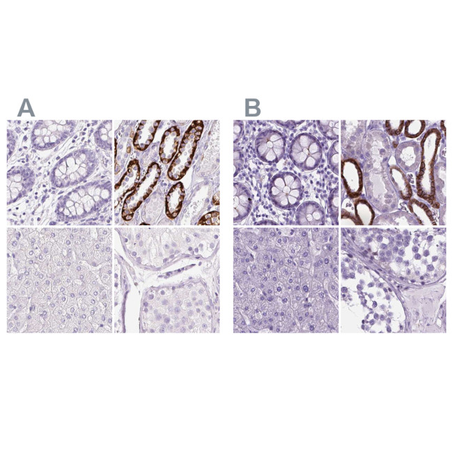 BSND Antibody in Immunohistochemistry (IHC)