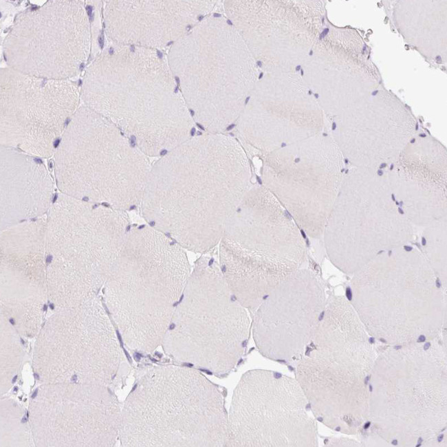 BSND Antibody in Immunohistochemistry (IHC)