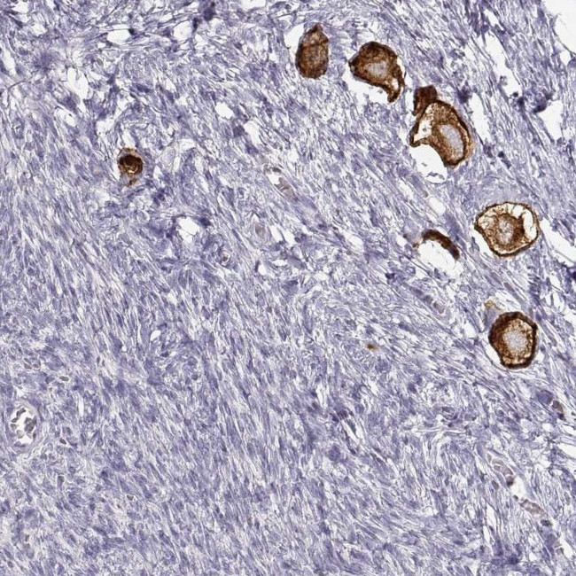 ZP3 Antibody in Immunohistochemistry (IHC)