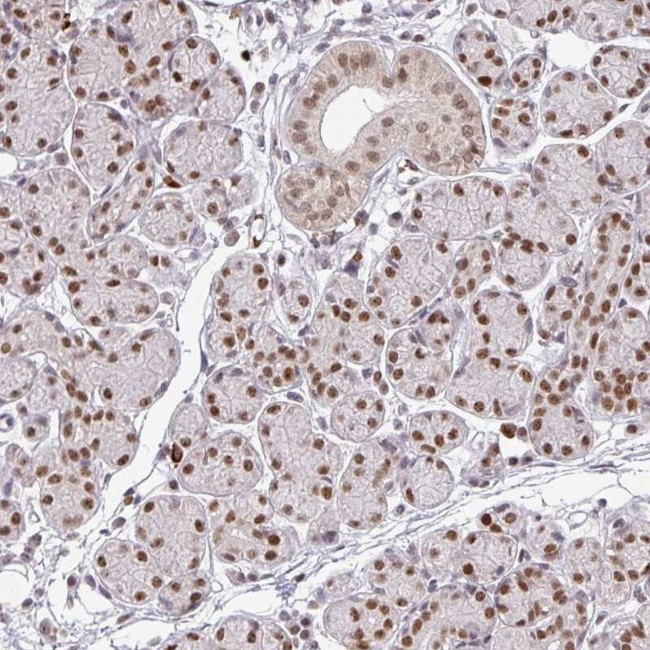 NEIL1 Antibody in Immunohistochemistry (IHC)