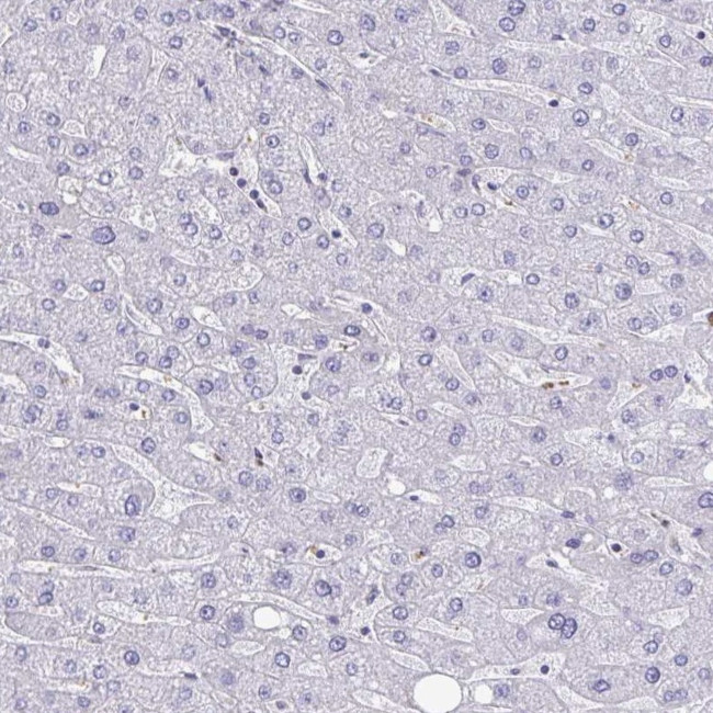 BCAT2 Antibody in Immunohistochemistry (IHC)