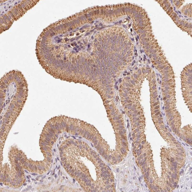 RAB35 Antibody in Immunohistochemistry (IHC)