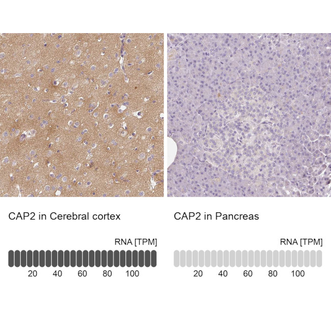 CAP2 Antibody in Immunohistochemistry (IHC)