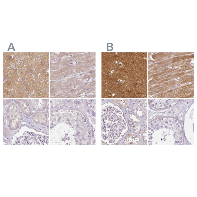 CAP2 Antibody in Immunohistochemistry (IHC)