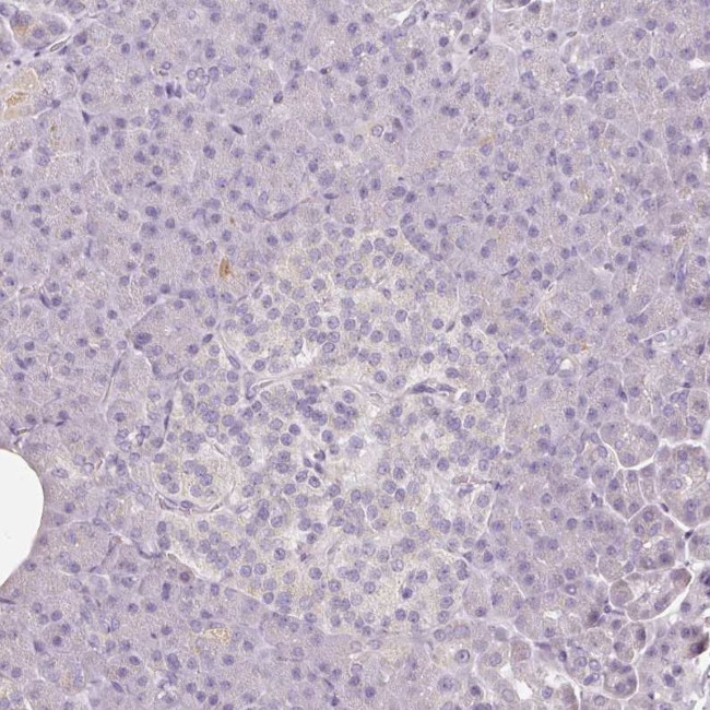 CAP2 Antibody in Immunohistochemistry (IHC)