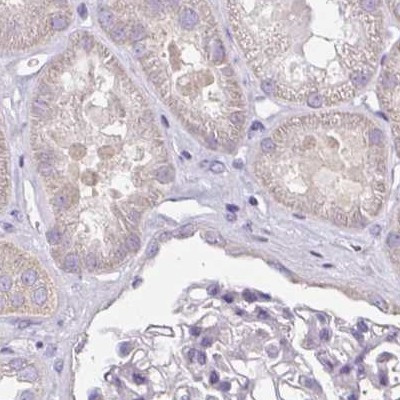 CAP2 Antibody in Immunohistochemistry (IHC)