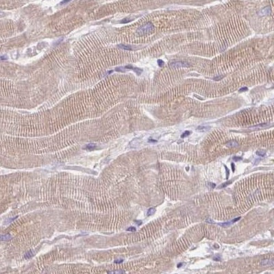 CAP2 Antibody in Immunohistochemistry (IHC)