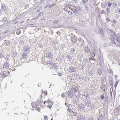 CAP2 Antibody in Immunohistochemistry (IHC)