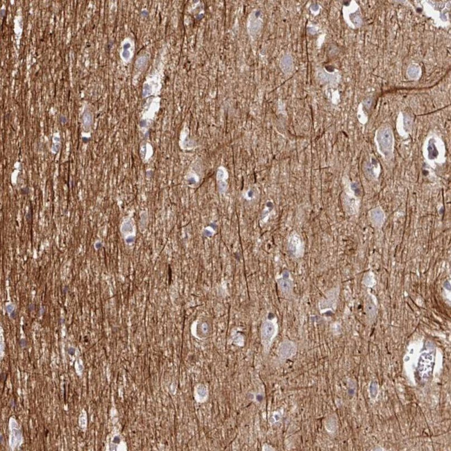 C1orf165 Antibody in Immunohistochemistry (IHC)