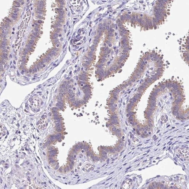 SKIV2L Antibody in Immunohistochemistry (IHC)