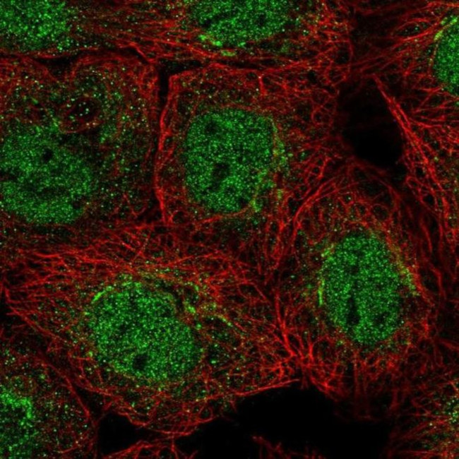 GOSR2 Antibody in Immunocytochemistry (ICC/IF)