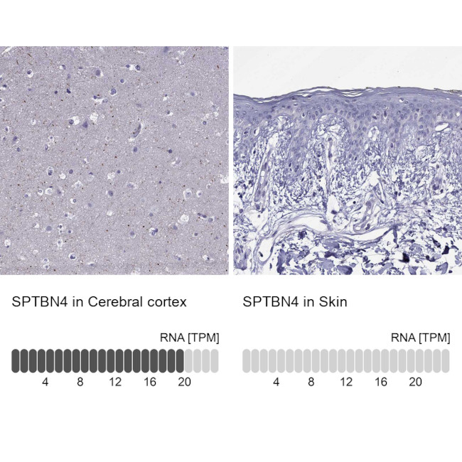 Spectrin beta-4 Antibody in Immunohistochemistry (IHC)