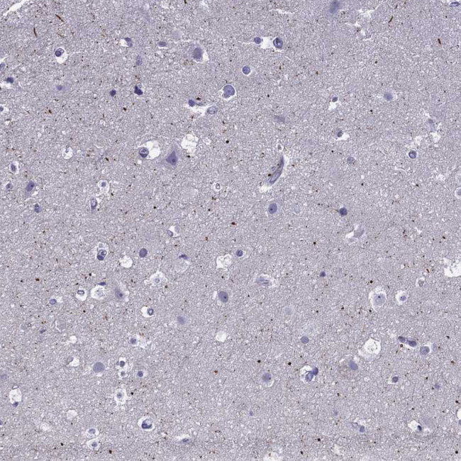 Spectrin beta-4 Antibody in Immunohistochemistry (IHC)