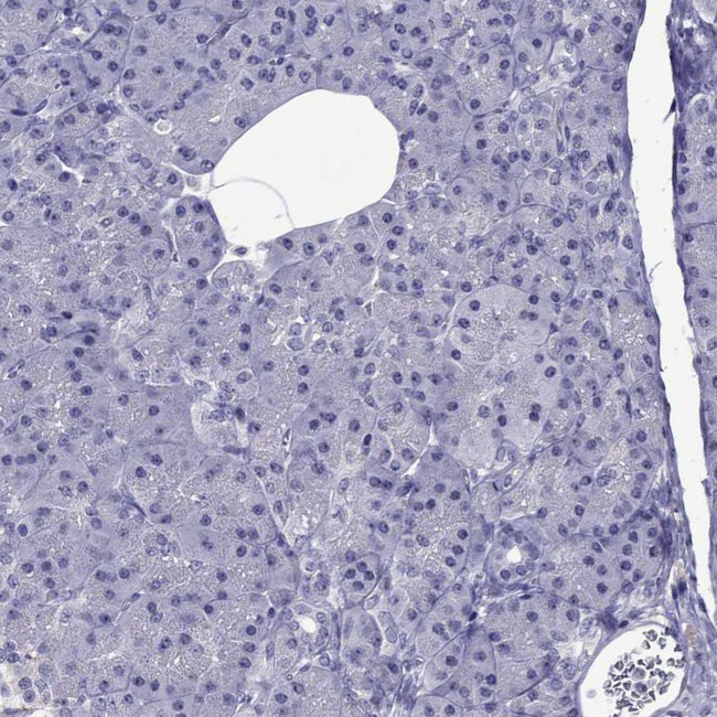 Spectrin beta-4 Antibody in Immunohistochemistry (IHC)