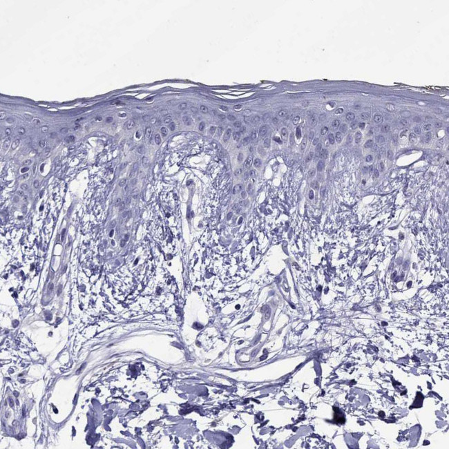 Spectrin beta-4 Antibody in Immunohistochemistry (IHC)