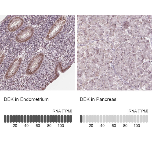 DEK Antibody in Immunohistochemistry (IHC)