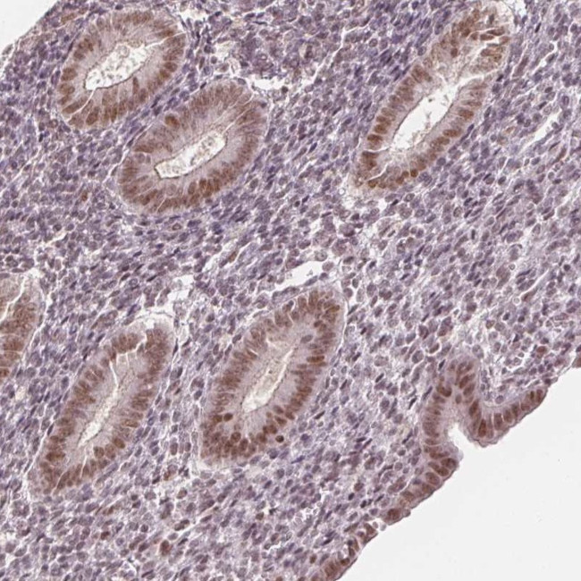 DEK Antibody in Immunohistochemistry (IHC)