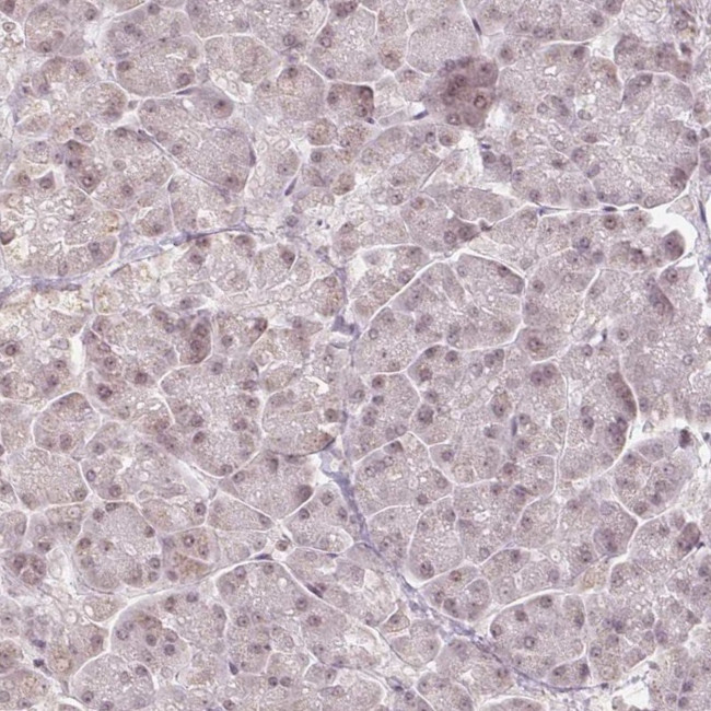 DEK Antibody in Immunohistochemistry (IHC)