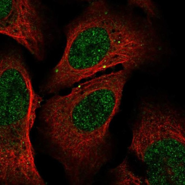 GSS Antibody in Immunocytochemistry (ICC/IF)