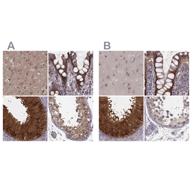 GSS Antibody in Immunohistochemistry (IHC)